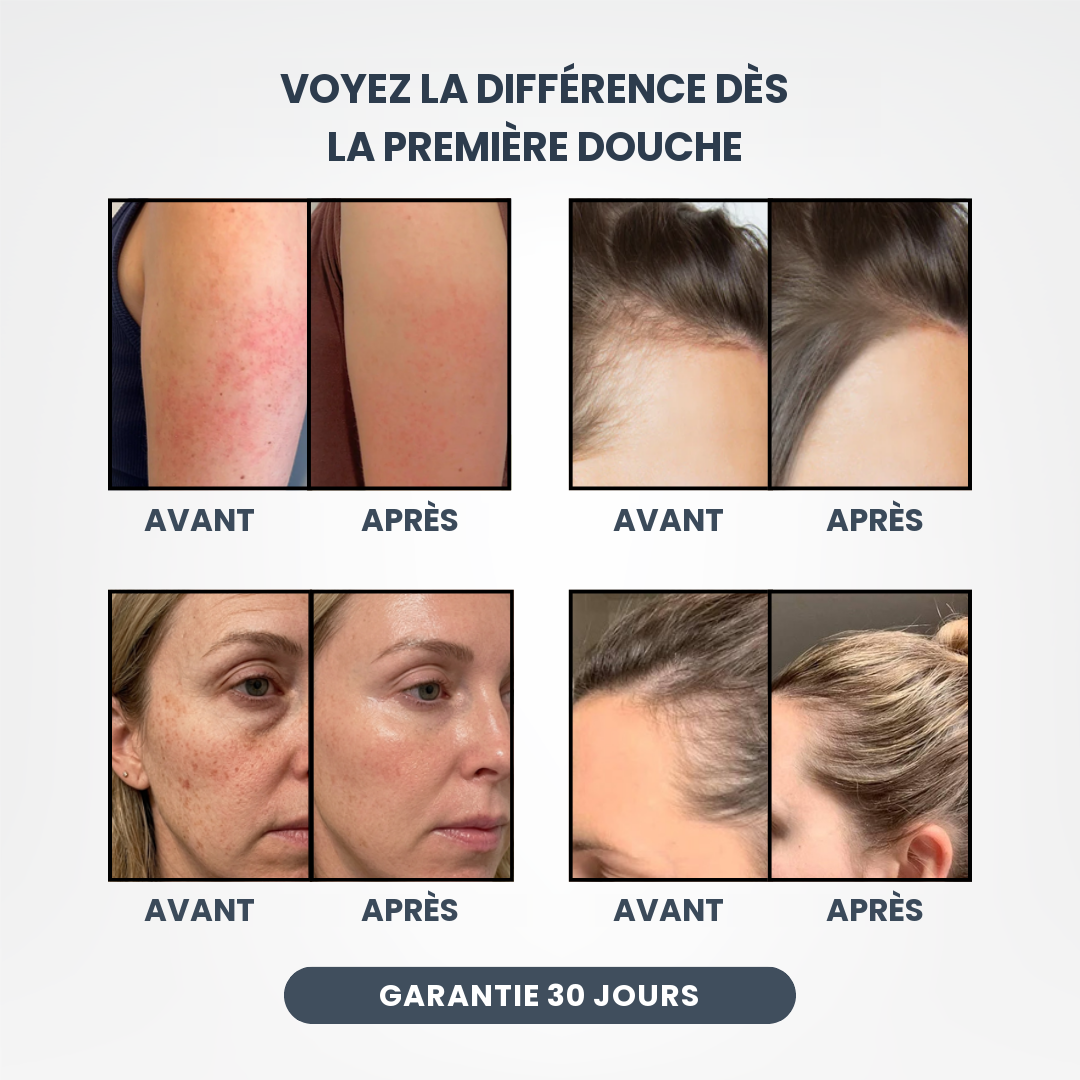 Avant et apres - peau et cheveux